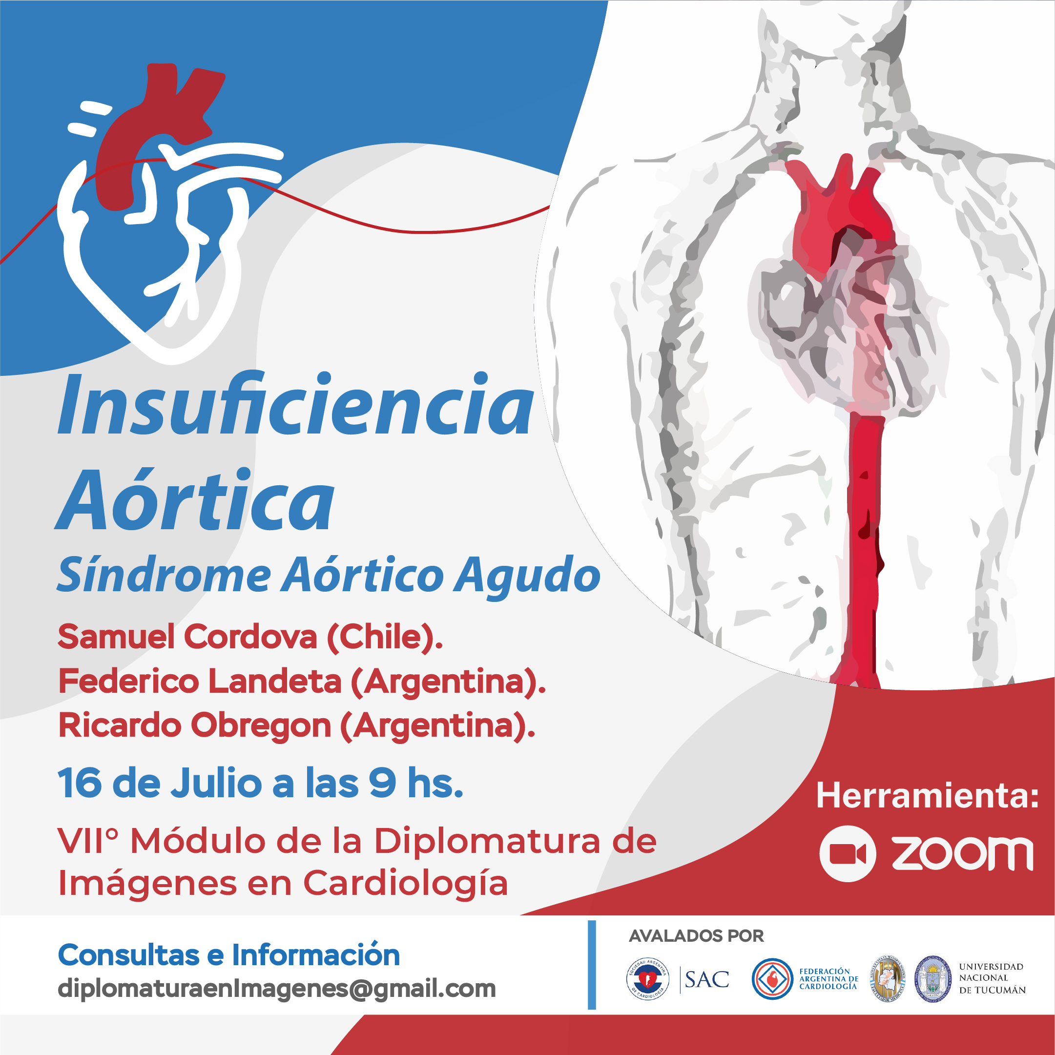 S ndrome A rtico Agudo SEDE Tucum n s-ndrome-a-rtico-agudo-sede-tucum-n